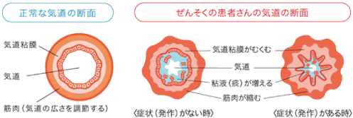 気管支の断面図