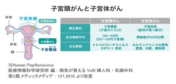 子宮頸がんと子宮体がん