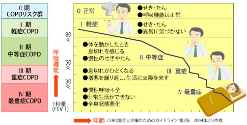 COPDの重症度