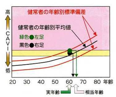 血管年齢参考イメージ