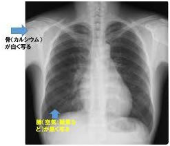 レントゲンに写るもの 医療法人社団 玲瓏会 金町中央病院