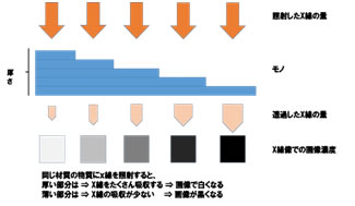 X線像の色の違い